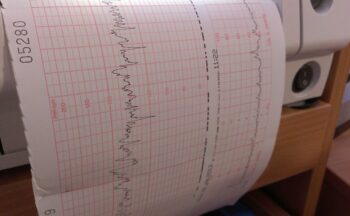 Fotografía ilustrativa de la actividad Uso del Efecto Doppler en la valoración vascular. Índice tobillo-brazo (ITB)