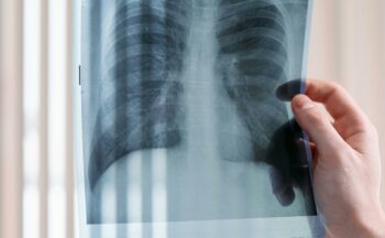Fotografía ilustrativa de la actividad Progresos y tendencias en resucitación cardiopulmonar moderna