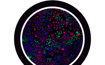 Fotografía ilustrativa de la actividad Cáncer y fármacos, ¿podrás encontrar la combinación para vencerlo?