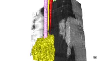 Fotografía ilustrativa de la actividad Cuando la ciencia enfoca: microscopía 3D para ir al hueso