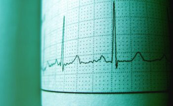 Fotografía ilustrativa de la actividad Variabilidad de la frecuencia cardiaca en el equilibrio Mente-Cuerpo