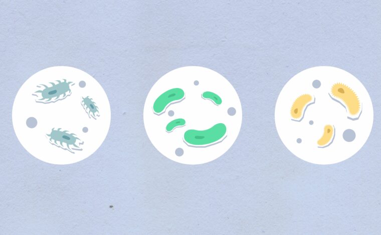 Imagen ilustrativa de la actividad