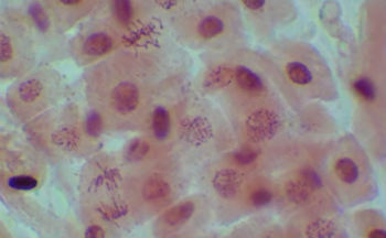 Fotografía ilustrativa de la actividad Taller GENyO | Visualización de cromosomas mediante microscopia óptica